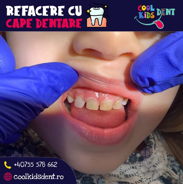 Cool Kids Dent - Stomatologie copii si adulti