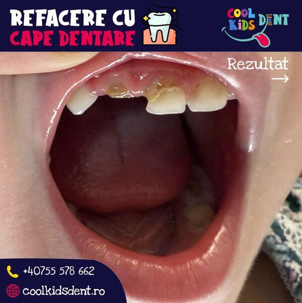 Cool Kids Dent - Stomatologie copii si adulti